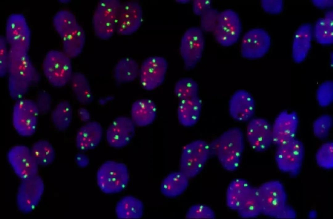 What is fluorescence insitu hybridization?
